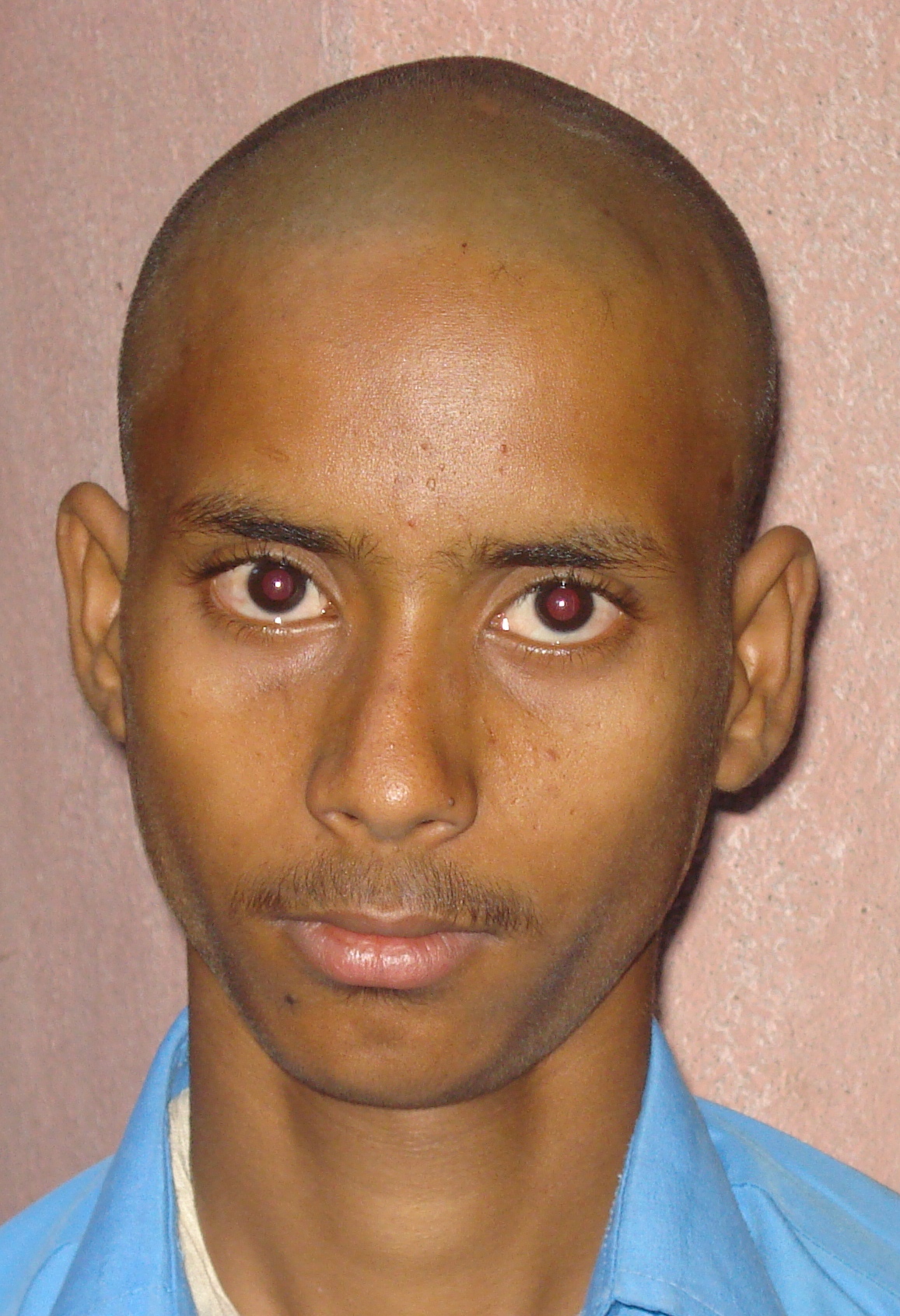 volunteer Ravi Ranjan